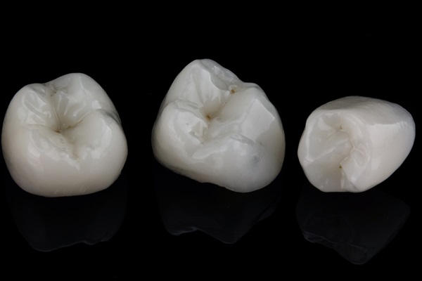 How Dental Crowns Are Used With Dental Fillings